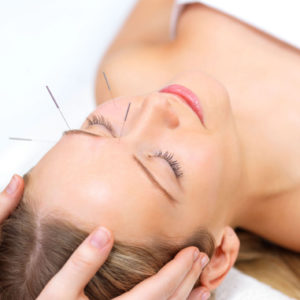 Acupuncture + moxibustion packages (60 min sessions)
