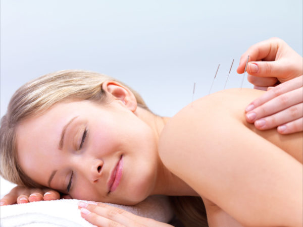 Acupunture packages (30 min sessions)
